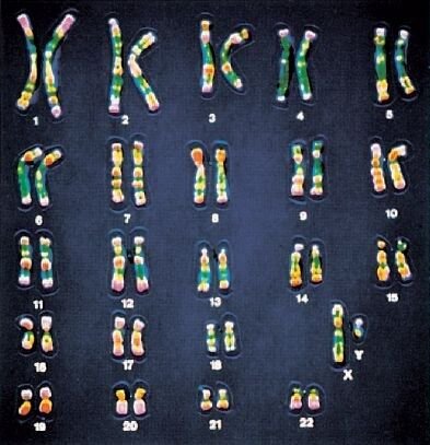A human karyotype: 23 numbered pairs of stained chromosomes arranged in a grid.