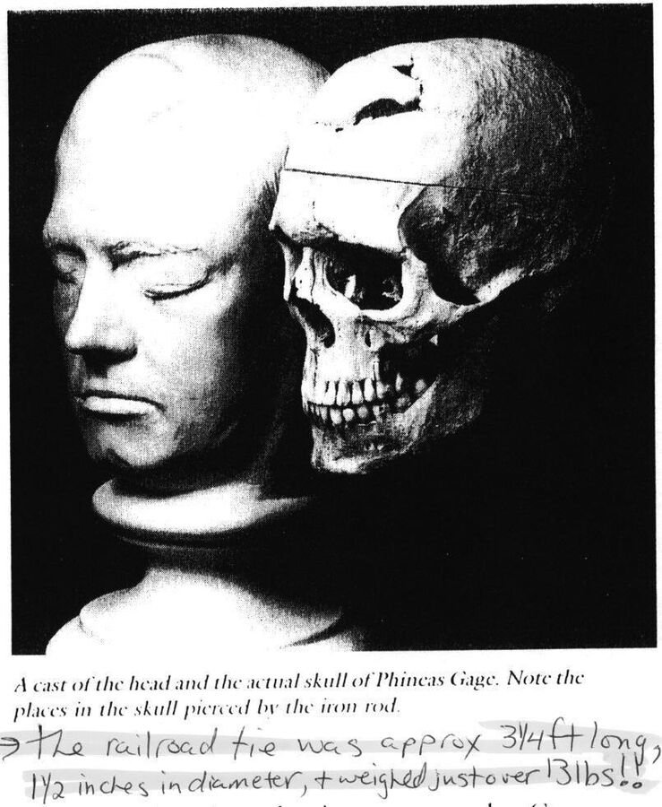 A photograph of a plaster cast of Gage's head beside his actual skull, with a handwritten note about the tamping iron's size and weight.