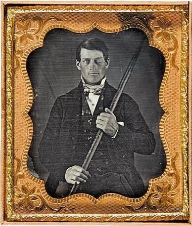 The famous daguerreotype of Phineas Gage, a young man in a suit holding the tamping iron that injured him.