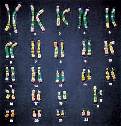 A stained human karyotype showing all 23 pairs of chromosomes arranged and numbered.